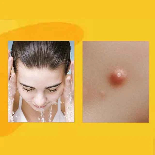 AQA™ TagRecede Bee Venom Treatment Spray