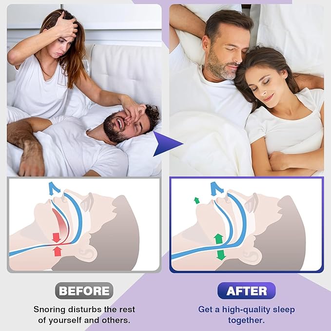 ANTI SNORING DEVICES(4pcs)
