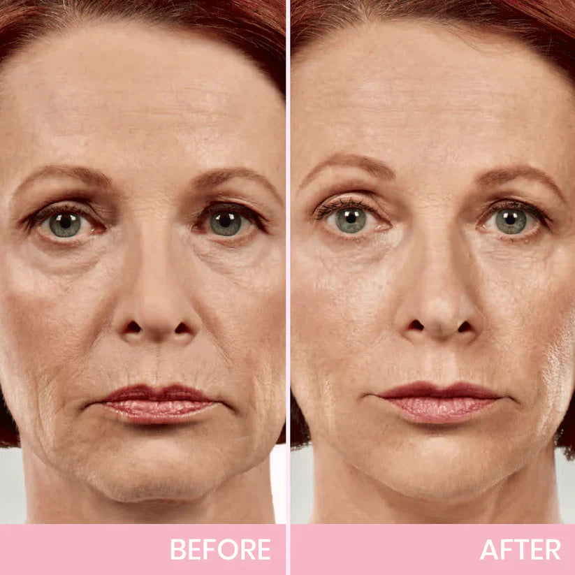 V-Face Lifting Adhesive Tape