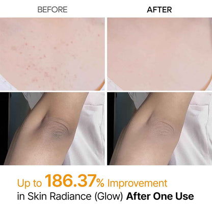 Body Peel Shot Spray