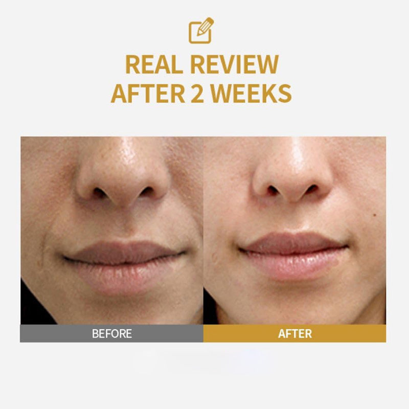 Silk Peptide Lifting Ampoule