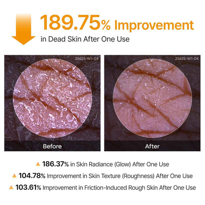 Body Peel Shot Spray