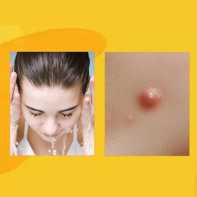 AQA™ TagRecede Bee Venom Treatment Spray